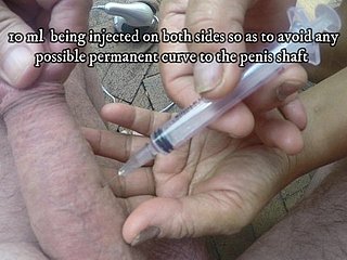 Injection  gives a rock-hard diet