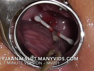 Любительский фрейджаанальслют: удаление ее IUD - вытягивая его из шейки матки Фрейджи, сделав ее плодородной снова - полная версия на MONYVIDS